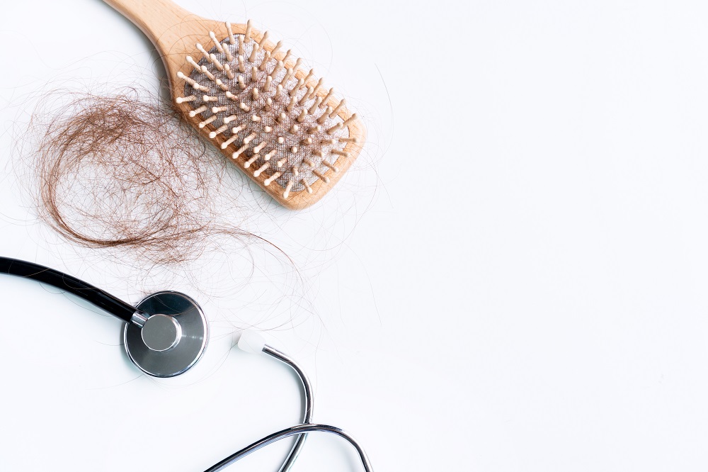 أفضل علاج لتساقط الشعر، وطرق الوقاية منه