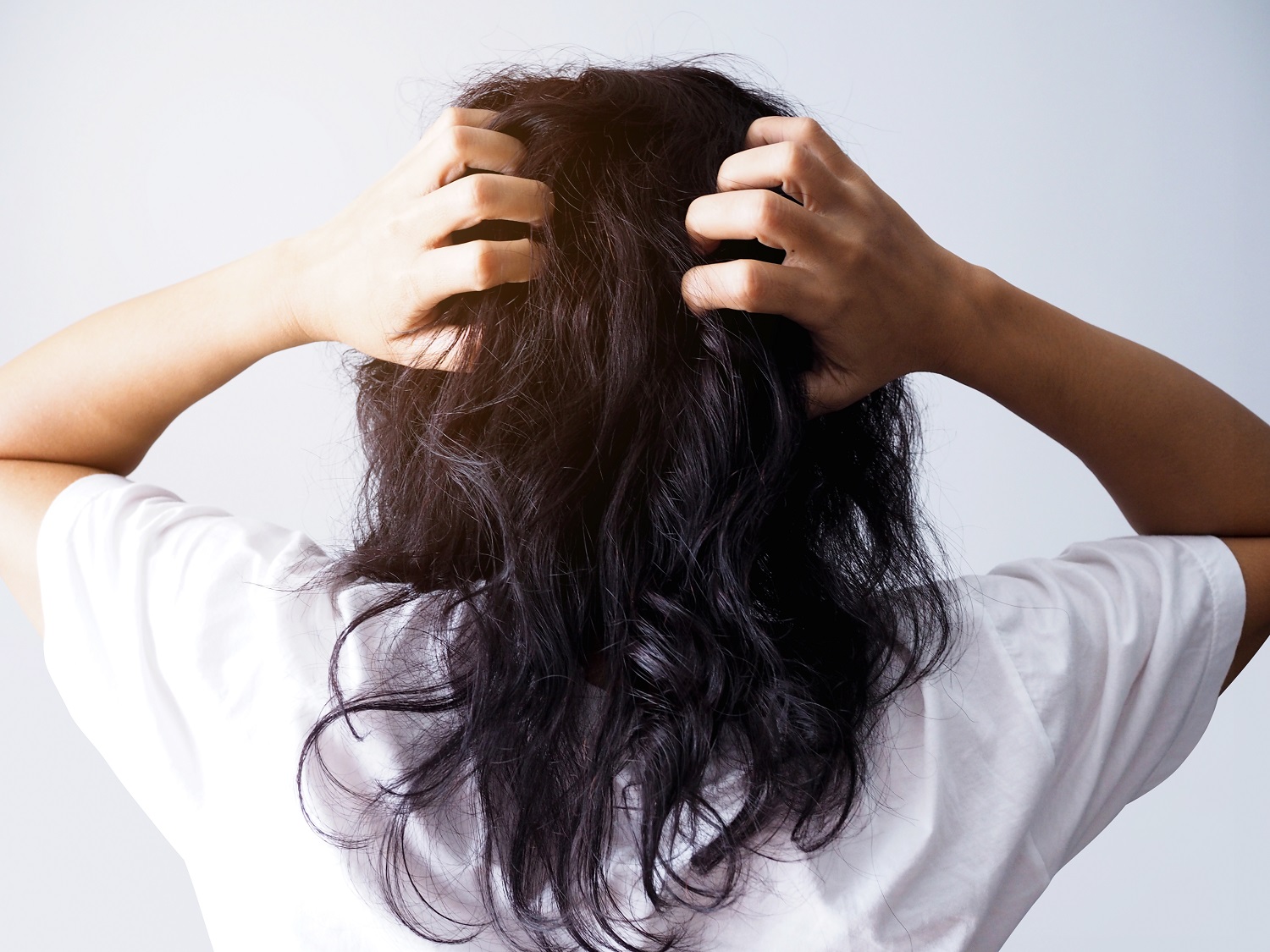 اكزيما الشعر: الأسباب، وطرق الوقاية منها