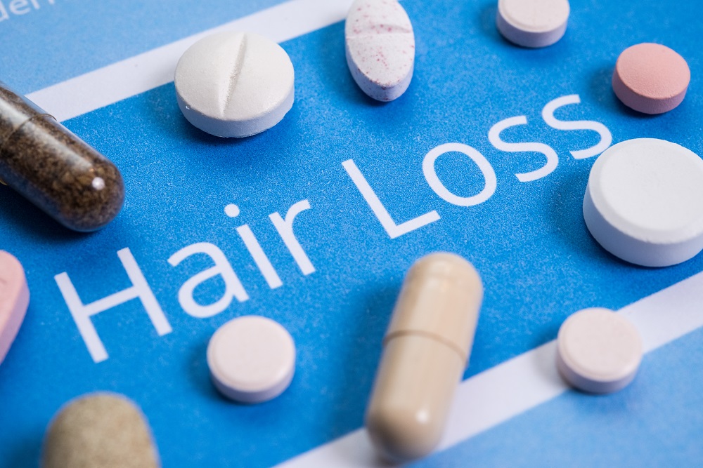 تساقط الشعر عند النساء: الأعراض، والأسباب وطرق العلاج