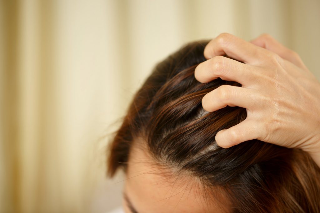 أعراض التهاب بصيلات الشعر وعلاجه