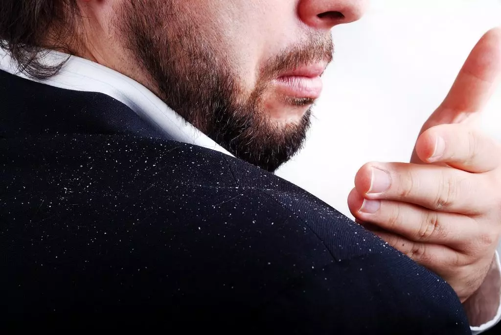 قشرة الرأس عند الرجال: الأسباب والحلول