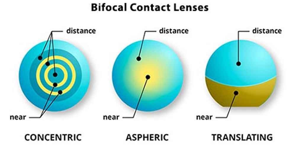 bifocal contact lenses