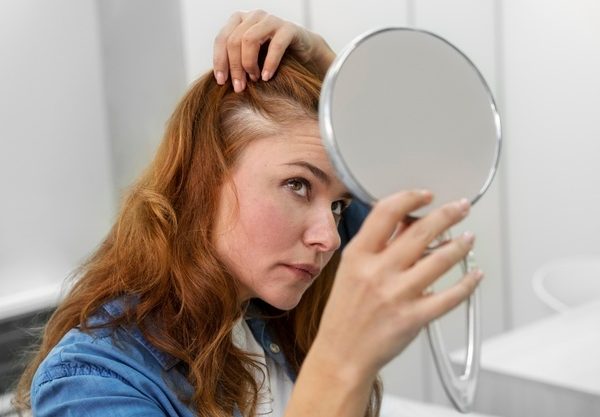 Androgenetic baldness in women: how to treat it