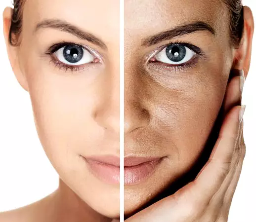 Facial Pigmentation Treatments
